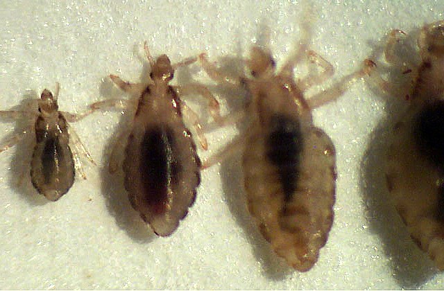 Lúsin er í heimsókn